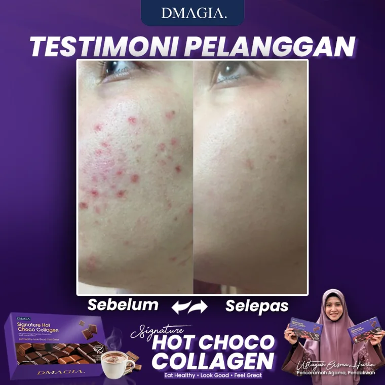 Testimoni 3