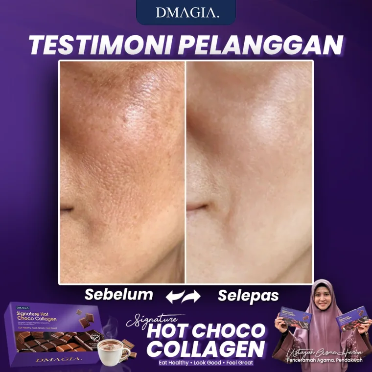 Testimoni 4