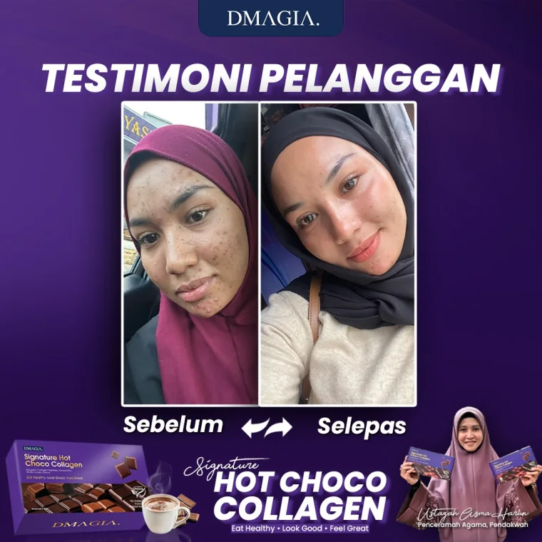 Transformasi Yanti