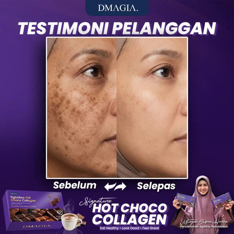 Testimoni 2